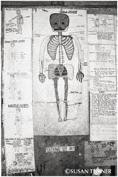 A "Rough" Human Skeleton